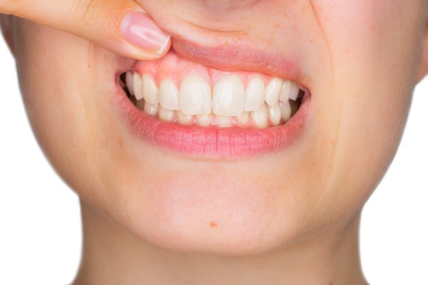 How A Dentist Treats Gum Disease