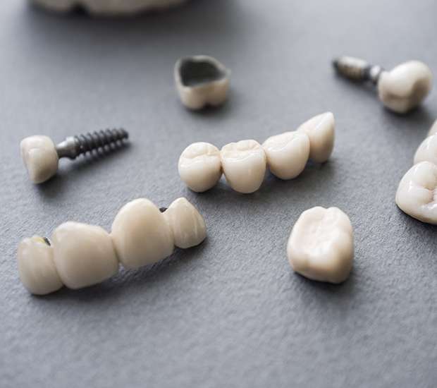 Temple The Difference Between Dental Implants and Mini Dental Implants