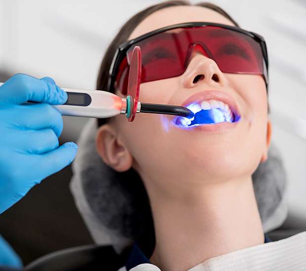 Temple Professional Teeth Whitening